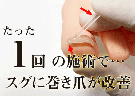 江坂巻き爪センター